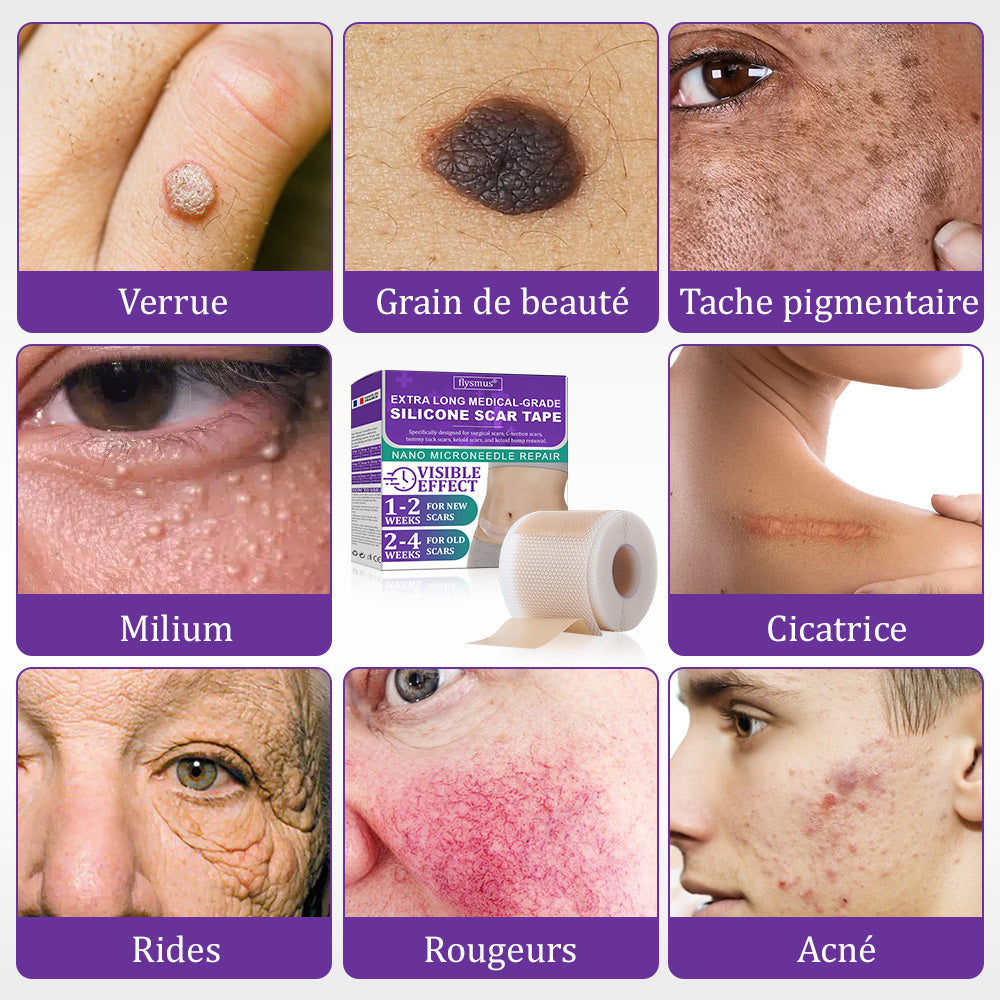 đŒđ·ïžBoutique officielle : FlysmusÂź ReGen Bandelette Microneedle Nano Ă  lâacide hyaluronique â Traitement efficace des cicatrices anciennes et rĂ©centes, cicatrices chirurgicales, vergetures, chĂ©loĂŻdes, acnĂ©, brĂ»lures, verrues, dermatomes et varices