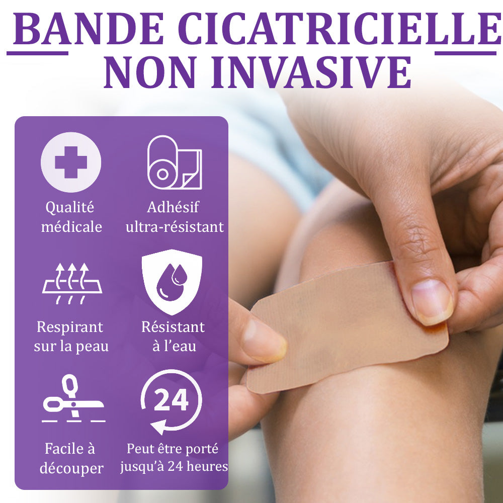 đŒđ·ïžBoutique officielle : FlysmusÂź ReGen Bandelette Microneedle Nano Ă  lâacide hyaluronique â Traitement efficace des cicatrices anciennes et rĂ©centes, cicatrices chirurgicales, vergetures, chĂ©loĂŻdes, acnĂ©, brĂ»lures, verrues, dermatomes et varices