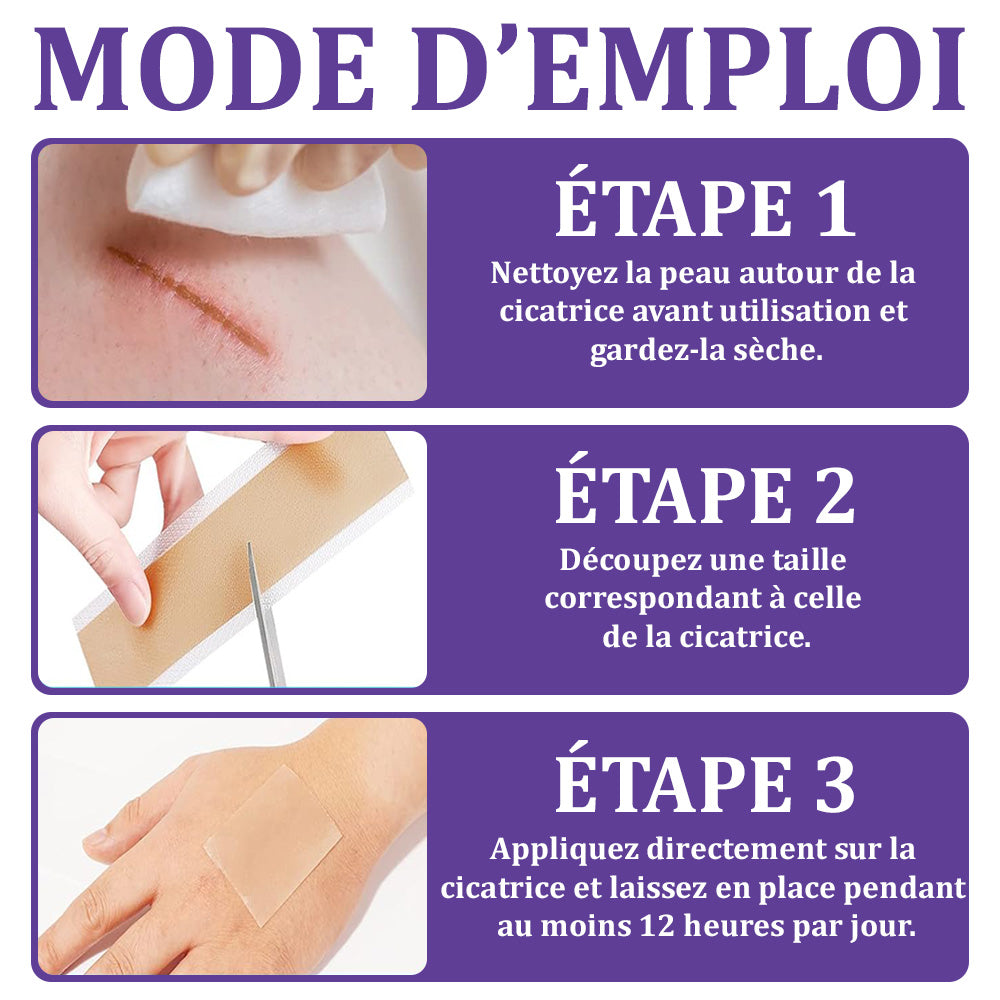 đŒđ·ïžBoutique officielle : FlysmusÂź ReGen Bandelette Microneedle Nano Ă  lâacide hyaluronique â Traitement efficace des cicatrices anciennes et rĂ©centes, cicatrices chirurgicales, vergetures, chĂ©loĂŻdes, acnĂ©, brĂ»lures, verrues, dermatomes et varices