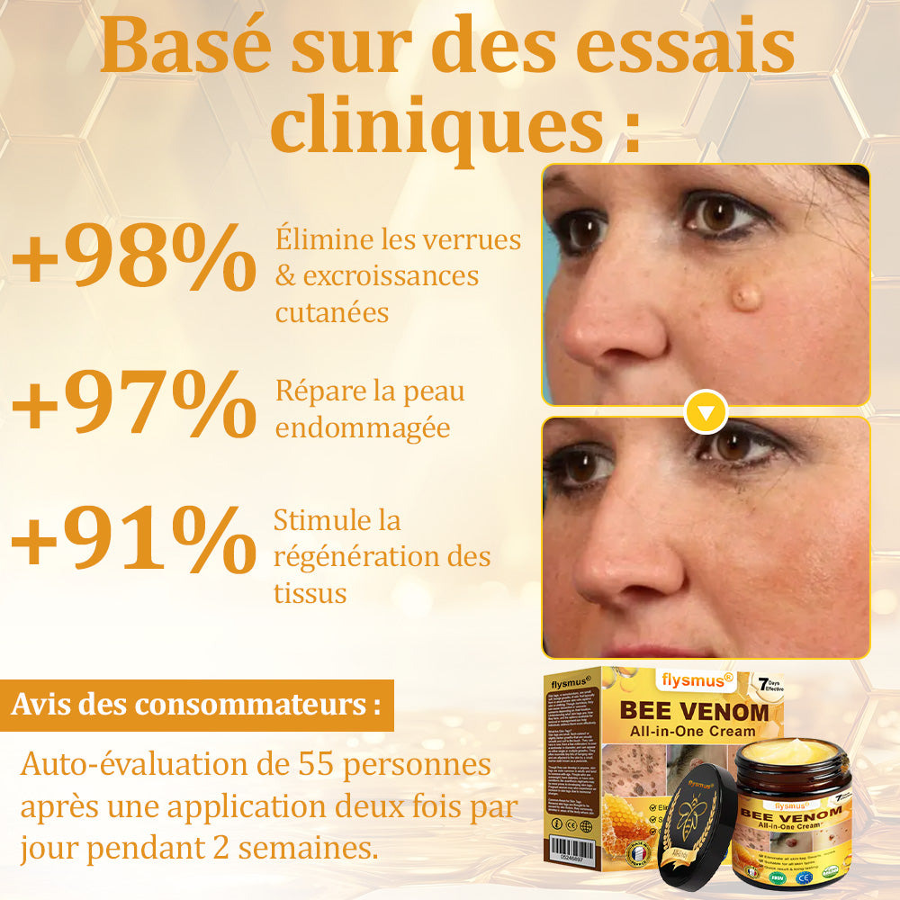 ✅flysmus® Crème au Venin d’Abeille – Dermatologiquement testée et recommandée par des dermatologues, traitement efficace des verrues, nodules et cicatrices.