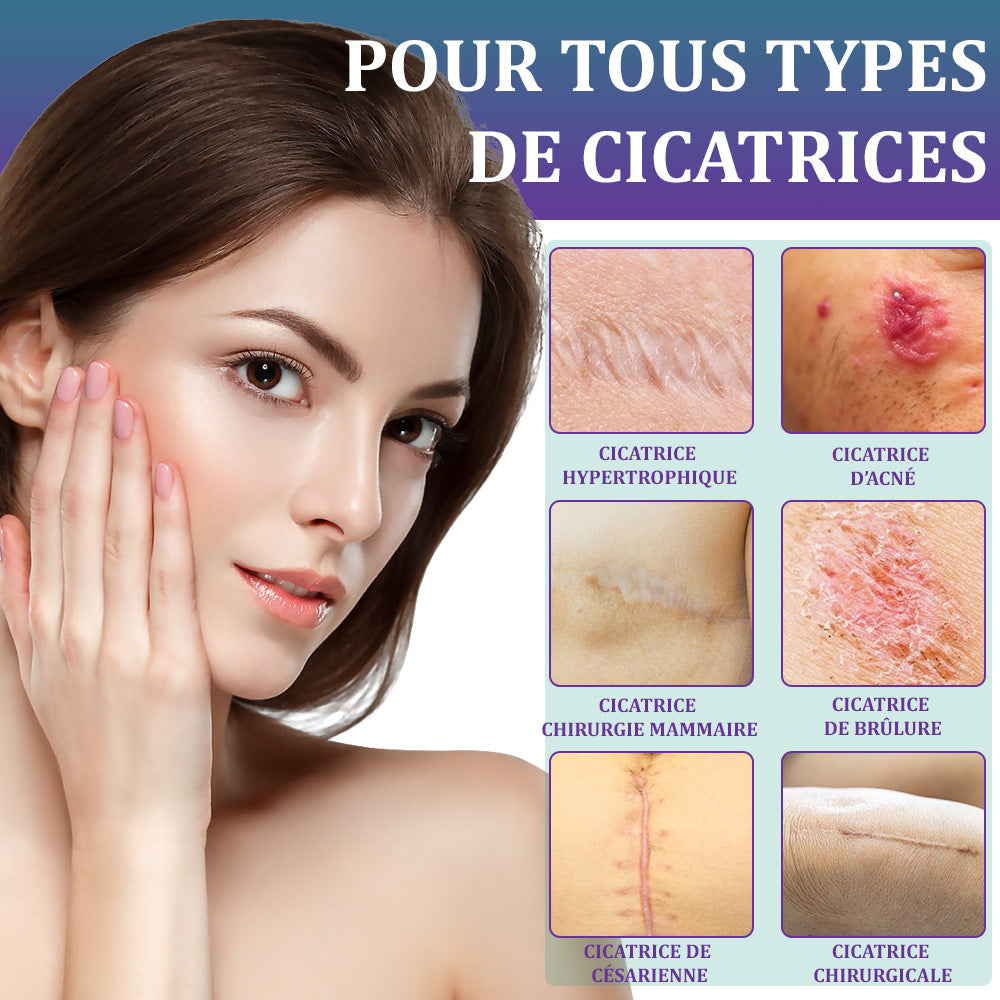🏷️Boutique officielle : Flysmus® ReGen Bandelette Microneedle Nano à l’acide hyaluronique — Traitement efficace des cicatrices anciennes et récentes, cicatrices chirurgicales, vergetures, chéloïdes, acné, brûlures, verrues, dermatomes et varices