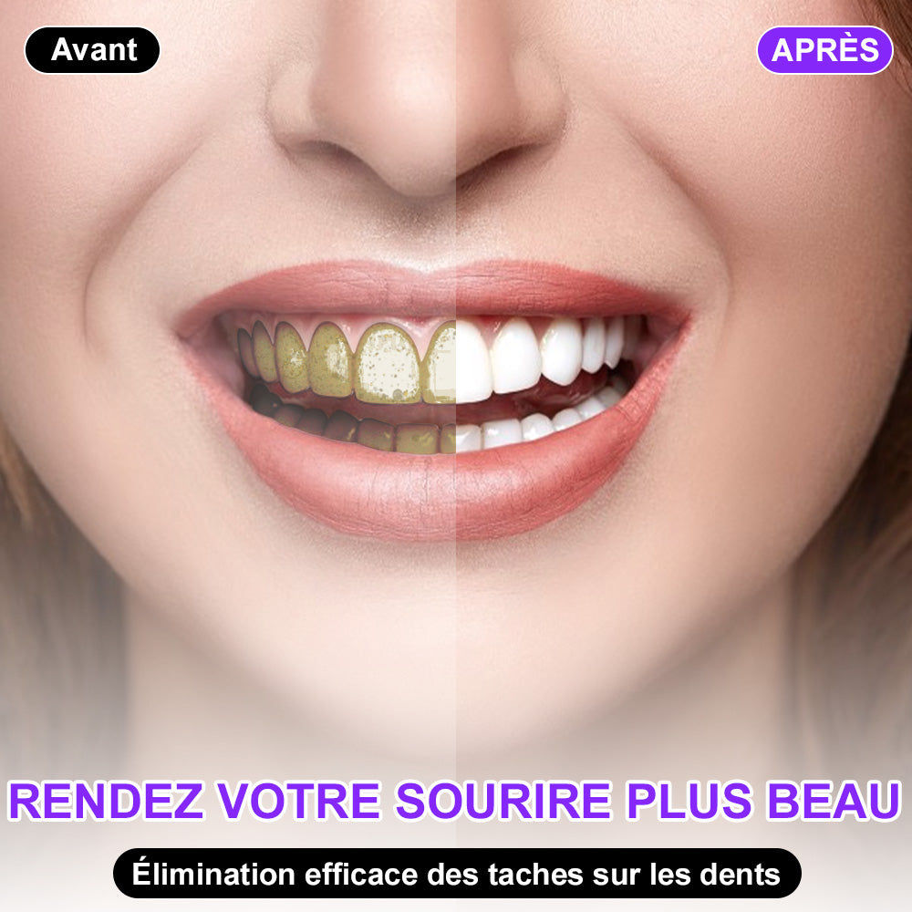 🦷Furzero®🦷 Sérum Correcteur de Couleur