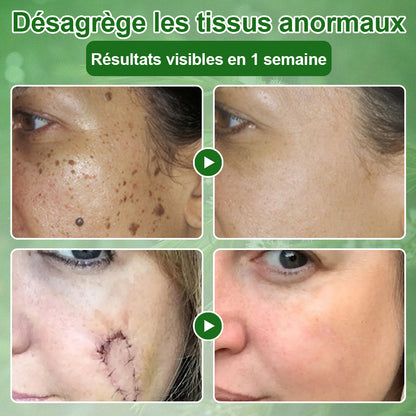 🌿𝐳𝐯𝐨𝐞𝐯𝐨® 𝐂𝐫𝐞̀𝐦𝐞 𝐝𝐞 𝐓𝐫𝐚𝐢𝐭𝐞𝐦𝐞𝐧𝐭 𝐚̀ 𝐥’𝐇𝐮𝐢𝐥𝐞 𝐝’𝐀𝐫𝐛𝐫𝐞 𝐚̀ 𝐓𝐡𝐞́ – Testée dermatologiquement et certifiée par des dermatologues. Une aide efficace contre les taches cutanées, les dommages de la peau, le teint irrégulier et les signes du vieillissement.