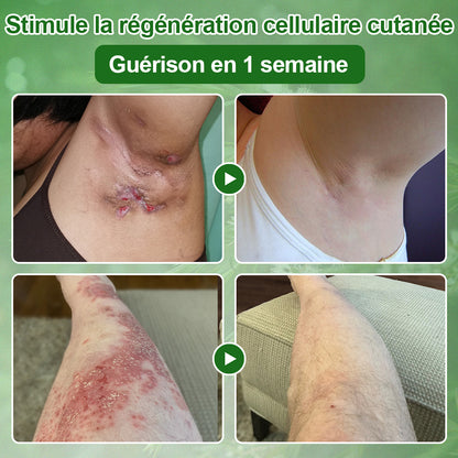 🌿𝐳𝐯𝐨𝐞𝐯𝐨® 𝐂𝐫𝐞̀𝐦𝐞 𝐝𝐞 𝐓𝐫𝐚𝐢𝐭𝐞𝐦𝐞𝐧𝐭 𝐚̀ 𝐥’𝐇𝐮𝐢𝐥𝐞 𝐝’𝐀𝐫𝐛𝐫𝐞 𝐚̀ 𝐓𝐡𝐞́ – Testée dermatologiquement et certifiée par des dermatologues. Une aide efficace contre les taches cutanées, les dommages de la peau, le teint irrégulier et les signes du vieillissement.