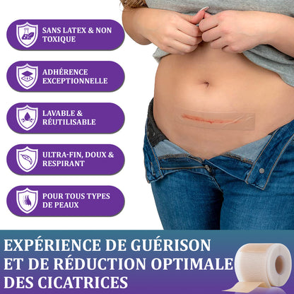 🏷️Boutique officielle : Flysmus® ReGen Bandelette Microneedle Nano à l’acide hyaluronique — Traitement efficace des cicatrices anciennes et récentes, cicatrices chirurgicales, vergetures, chéloïdes, acné, brûlures, verrues, dermatomes et varices