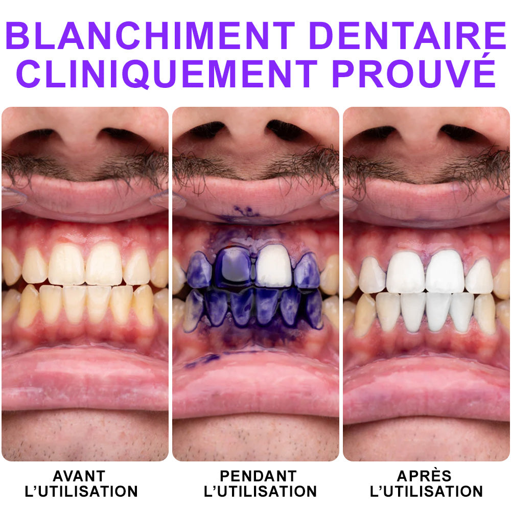 🦷Furzero®🦷 Sérum Correcteur de Couleur