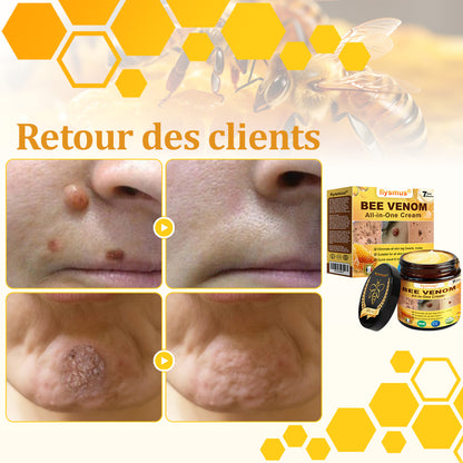 ✅flysmus® Crème au Venin d’Abeille – Dermatologiquement testée et recommandée par des dermatologues, traitement efficace des verrues, nodules et cicatrices.