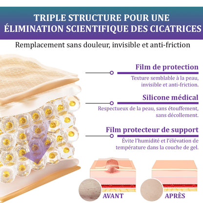🏷️Boutique officielle : Flysmus® ReGen Bandelette Microneedle Nano à l’acide hyaluronique — Traitement efficace des cicatrices anciennes et récentes, cicatrices chirurgicales, vergetures, chéloïdes, acné, brûlures, verrues, dermatomes et varices