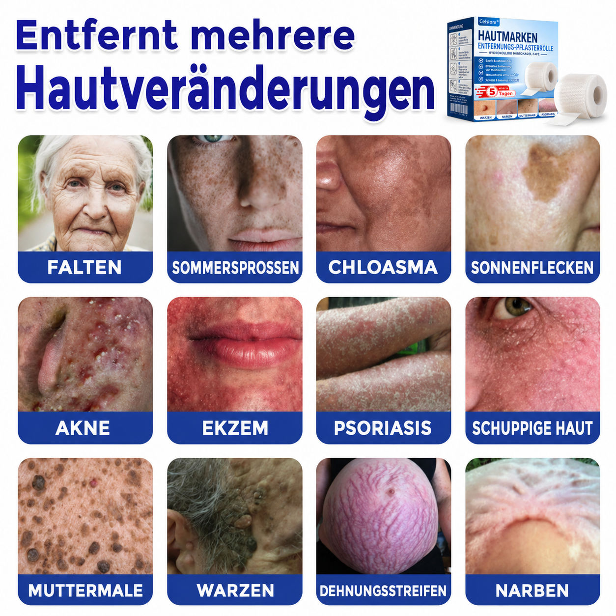 🫧🌟Celsiora® Multi-Functional Microneedle Hydrocolloid Patch Roll | Unterstützt die Pflege von Hautanhängseln, Warzen & hartnäckigen Hautunreinheiten