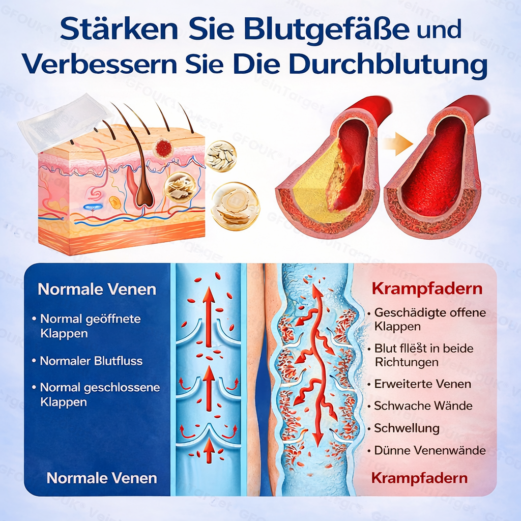 🦩✅GFOUK® VeinTarget Microneedle Patch ⚡ Sofortige Linderung, langfristige Ergebnisse